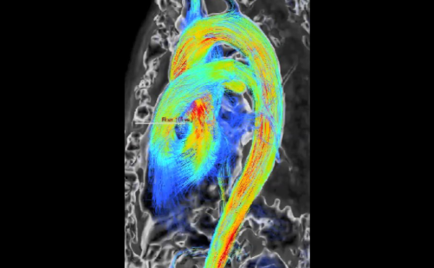 Imaging example 1