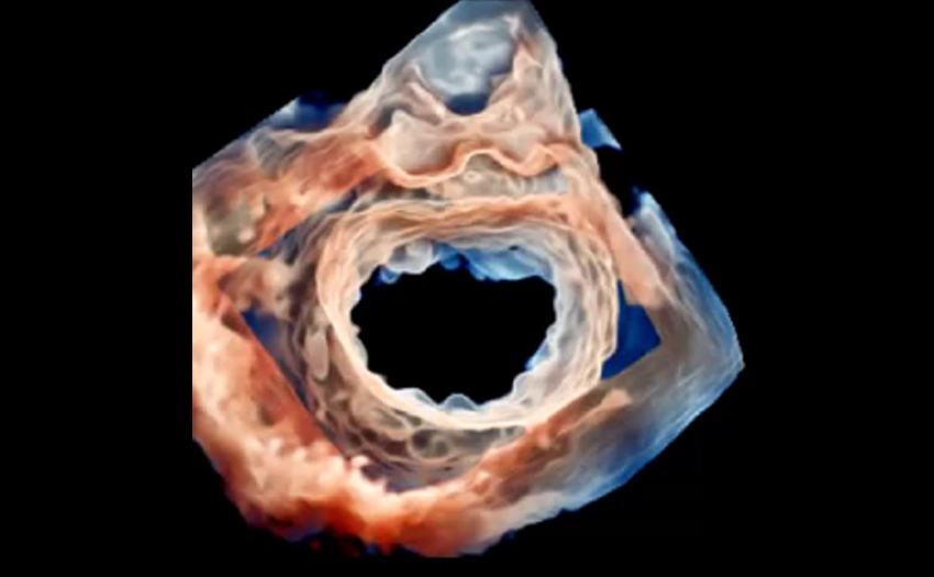 Imaging example 3