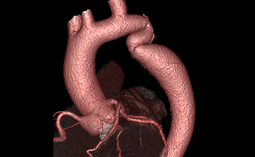 Imaging example 6