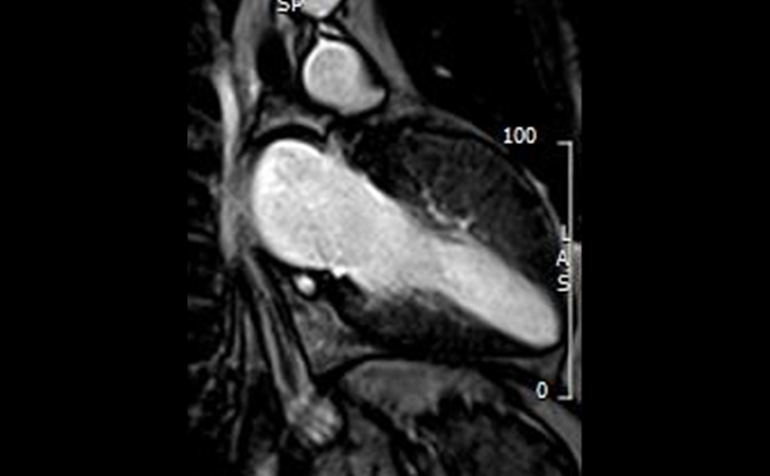Imaging example 4