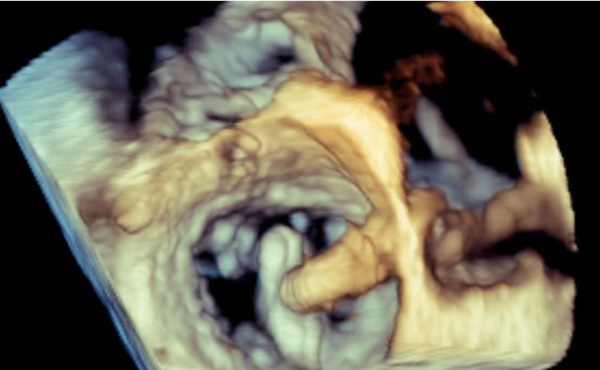 Imaging example 5