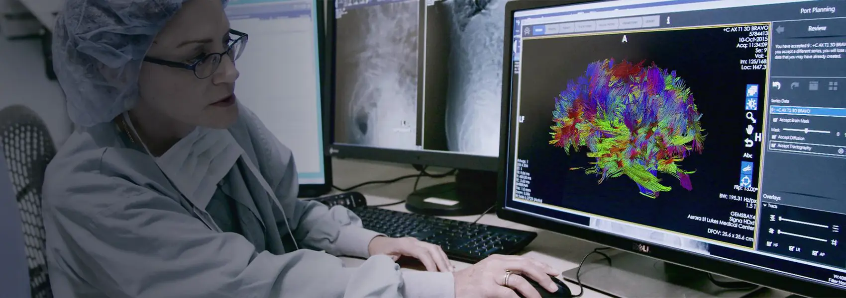 brain mapping